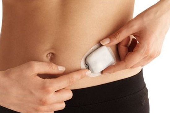 Diabete un cerotto sostituirà l'insulina. L'invenzione di un'equipe americana